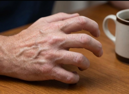 손가락에 쥐가 나는 이유는? 7가지 원인과 예방 방법 정리